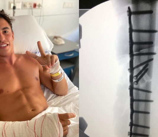 Marc Marquez dedahkan gambar X-ray lengannya ‘sebelum dan selepas’