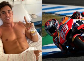 Marc Marquez perlu rehat 2 hingga 3 bulan sebelum kembali ke MotoGP