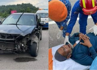 Datuk Nash kemalangan, luka pada muka dan sakit dada