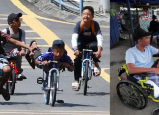 Lumpuh seumur hidup, hilang kaki kiri kerana basikal lajak….
