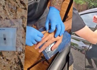 Cara selamat simpan kunci kereta, pemilik Tesla ini implan cip pada tangan