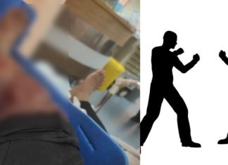 Kereta berlanggar, mangsa putus jari ditetak pedang samurai