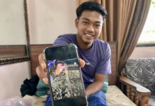 Patah tulang kaki terkena serpihan besi di LPT 2